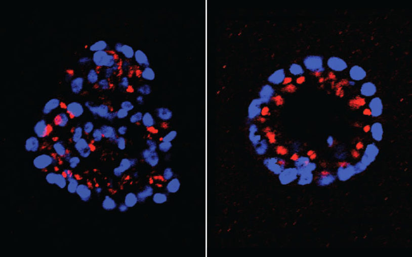 Mammary Epithelial Cells