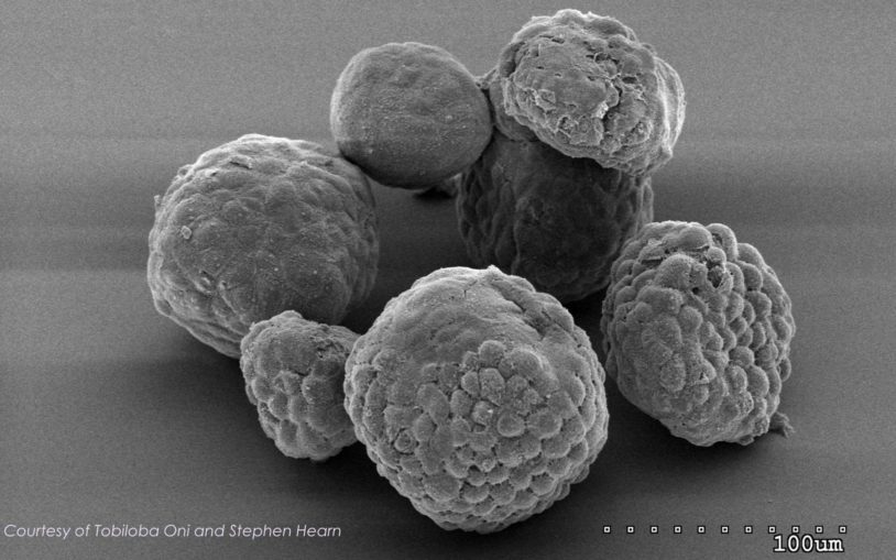 electron microscopy image of organoids