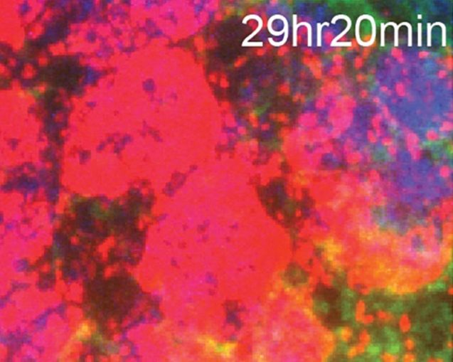 photo of immune cells taken by a microscope