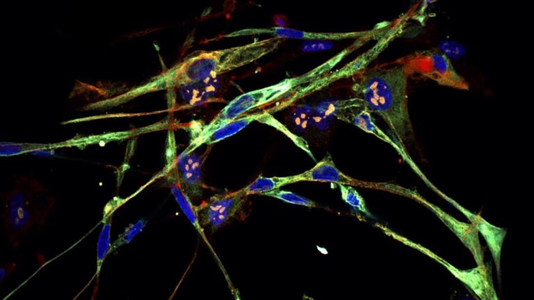 image of RMS cells transformed into muscle cells