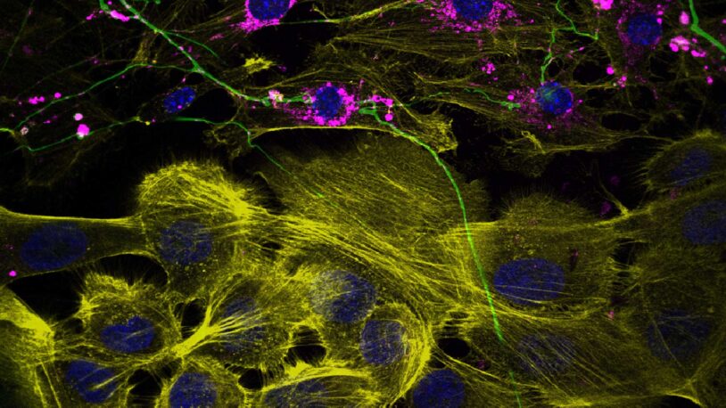 image of breast cells with mouse neurons