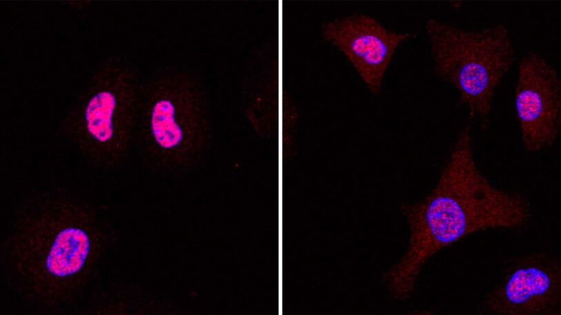 image of Lung Cancer cells