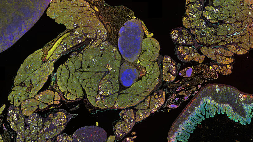 image of FGR2 and EGFR proteins