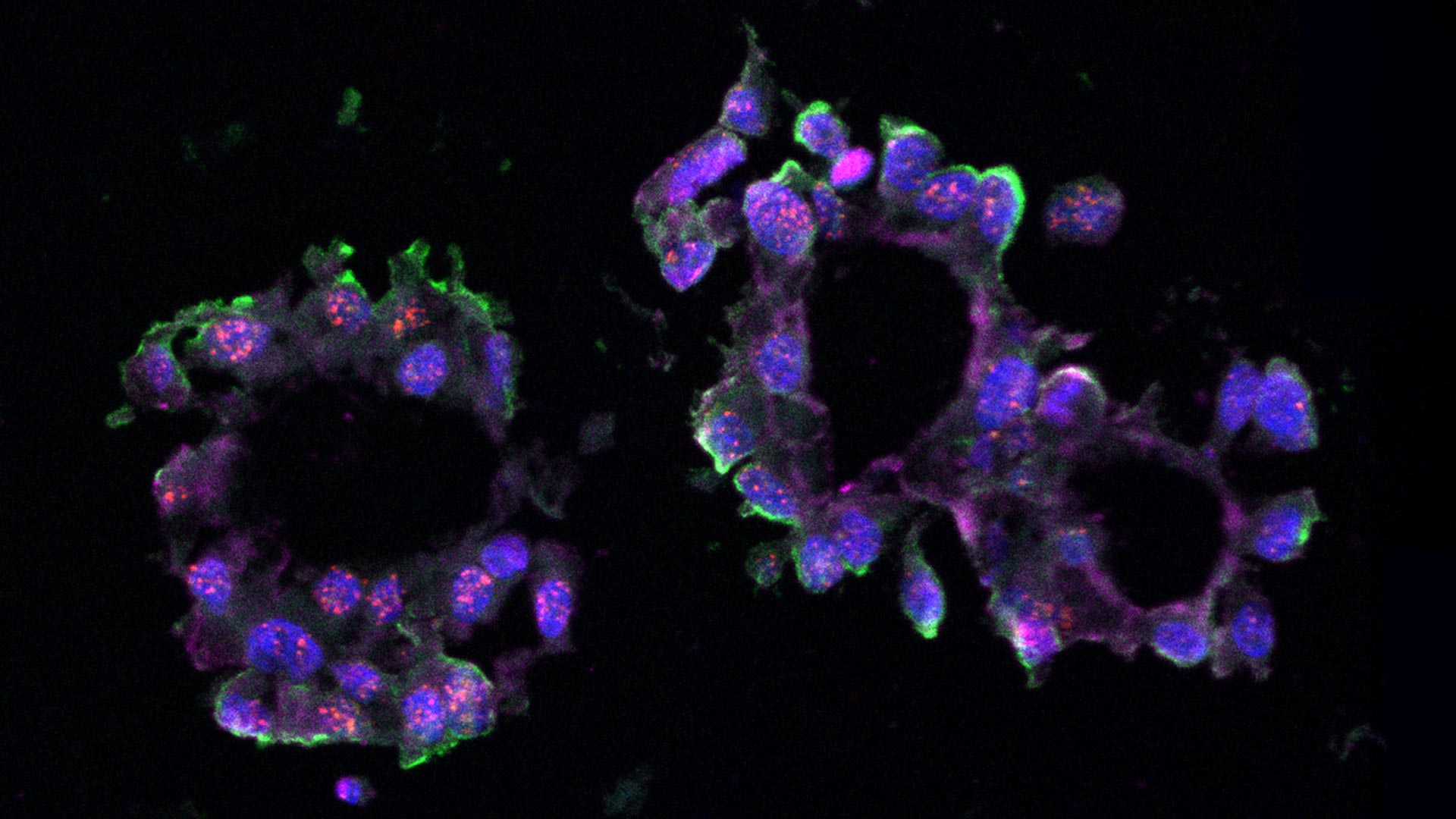 Image of a triple-negative breast cancer organoid