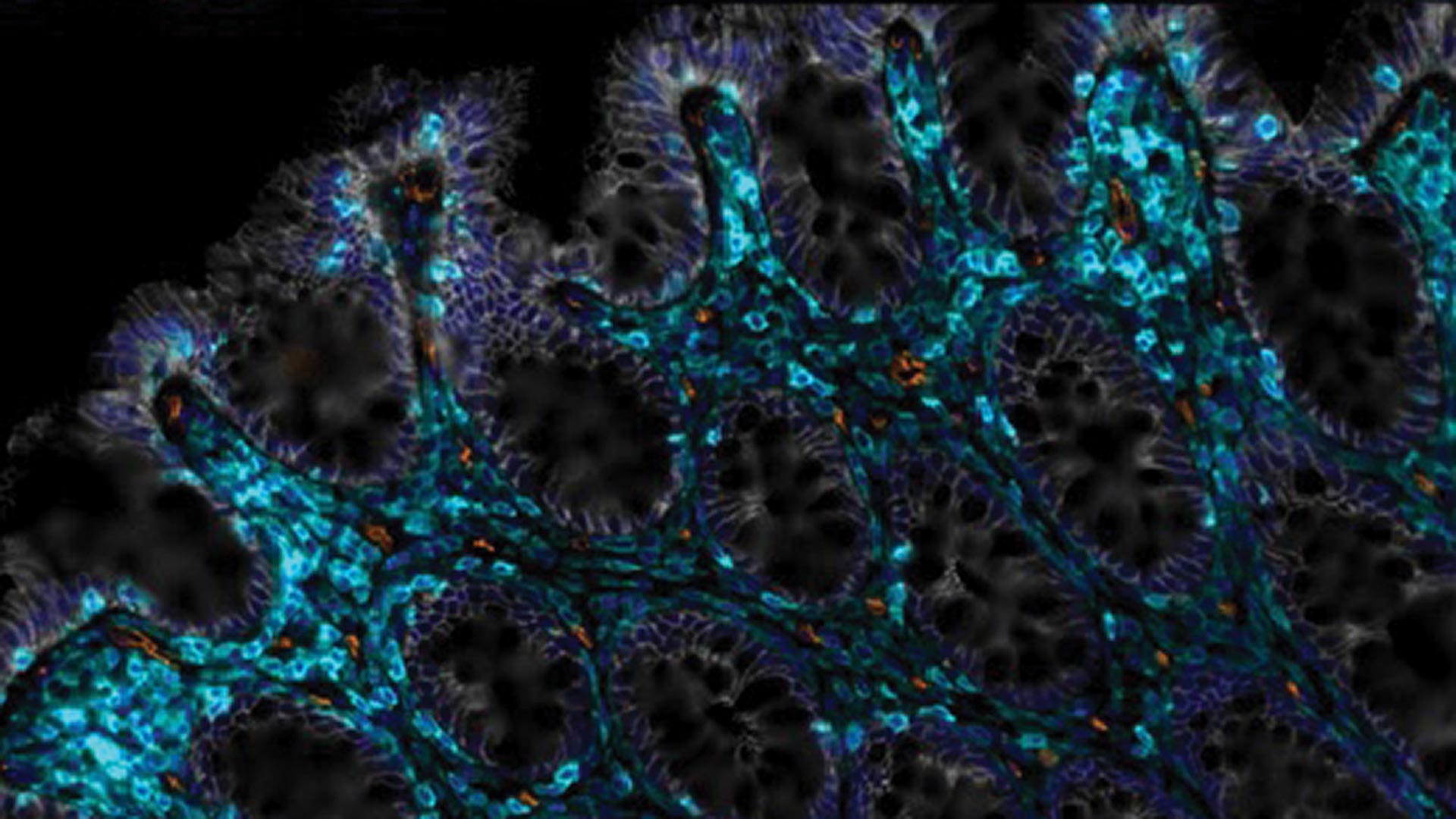 Microscopic view of tissue with blue, orange, and black highlighted cells and intricate structures.