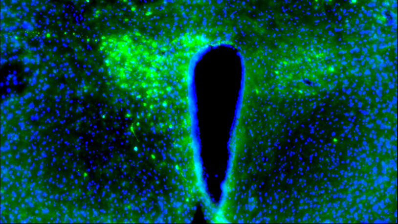 Fluorescent microscopic image showing a keyhole-shaped dark area surrounded by green and blue speckled cells.