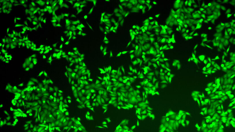 Fluorescent green-stained organoid cells viewed under a microscope, clustered against a dark background.
